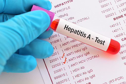 Hepatitis A Vaccine how long does it last?