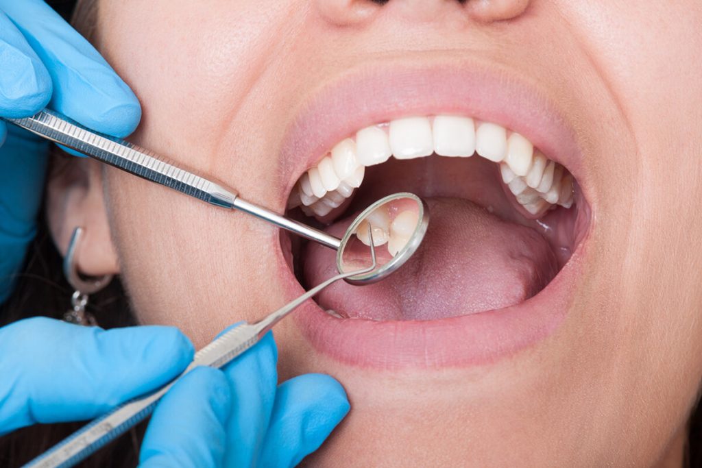 how long does a dental cleaning take